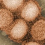 Cientista explica varíola dos macacos