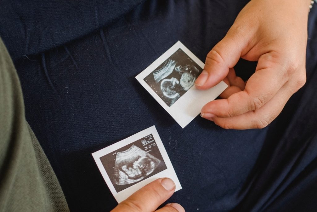 Vídeo foi compartilhado nas redes sociais e mostrou com precisão e qualidade imagens do feto no útero com apenas 10 semanas em um caso raro de gravidez