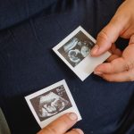 Vídeo foi compartilhado nas redes sociais e mostrou com precisão e qualidade imagens do feto no útero com apenas 10 semanas em um caso raro de gravidez