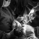Bebê morre durante o parto