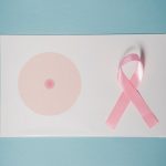 Estudo relaciona sono e células de câncer de mama