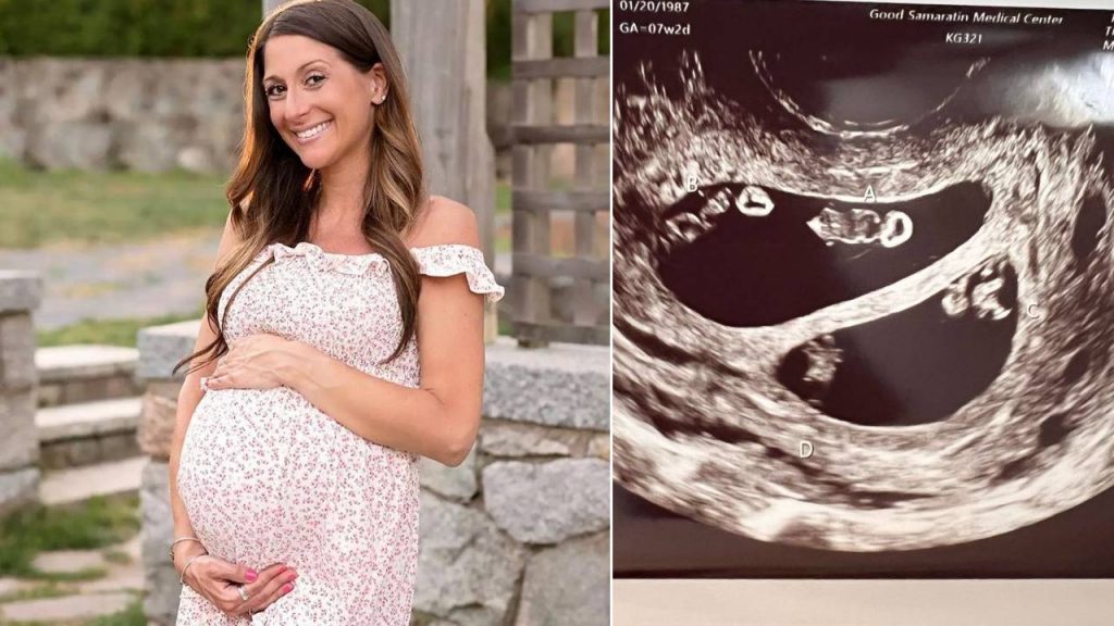 Com chance de 1 em 10 milhões, mulher descobre que está grávida de dois pares de gêmeos idênticos