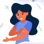 Monkeypox, alergia, herpes ou picada de inseto? Saiba diferenciar as irritações na pele