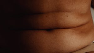 Segundo pesquisa, três a cada 10 brasileiros serão obesos em 2030, além disso, 68,1% estará em sobrepeso