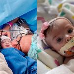 Letícia Cazarré compartilhou que filha passará por nova cirurgia nessa terça-feira, 27, na esperança que ela seja curada da condição