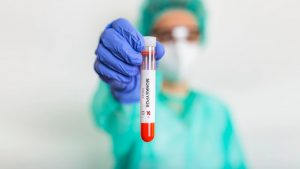 Anvisa anunciou nesta terça-feira, 20 de setembro, a aprovação do kit de teste desenvolvido pela Fiocruz para diagnóstico da monkeypox