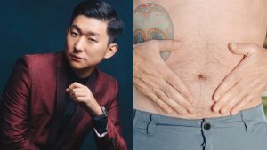 Pyong Lee explica efeitos da hipnoterapia na suavização de sintomas da síndrome do intestino irritável, comprovados em estudo de 2018