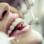 Cirurgião dentista alerta sobre cuidados antes e após a extração do siso