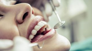 Cirurgião dentista alerta sobre cuidados antes e após a extração do siso