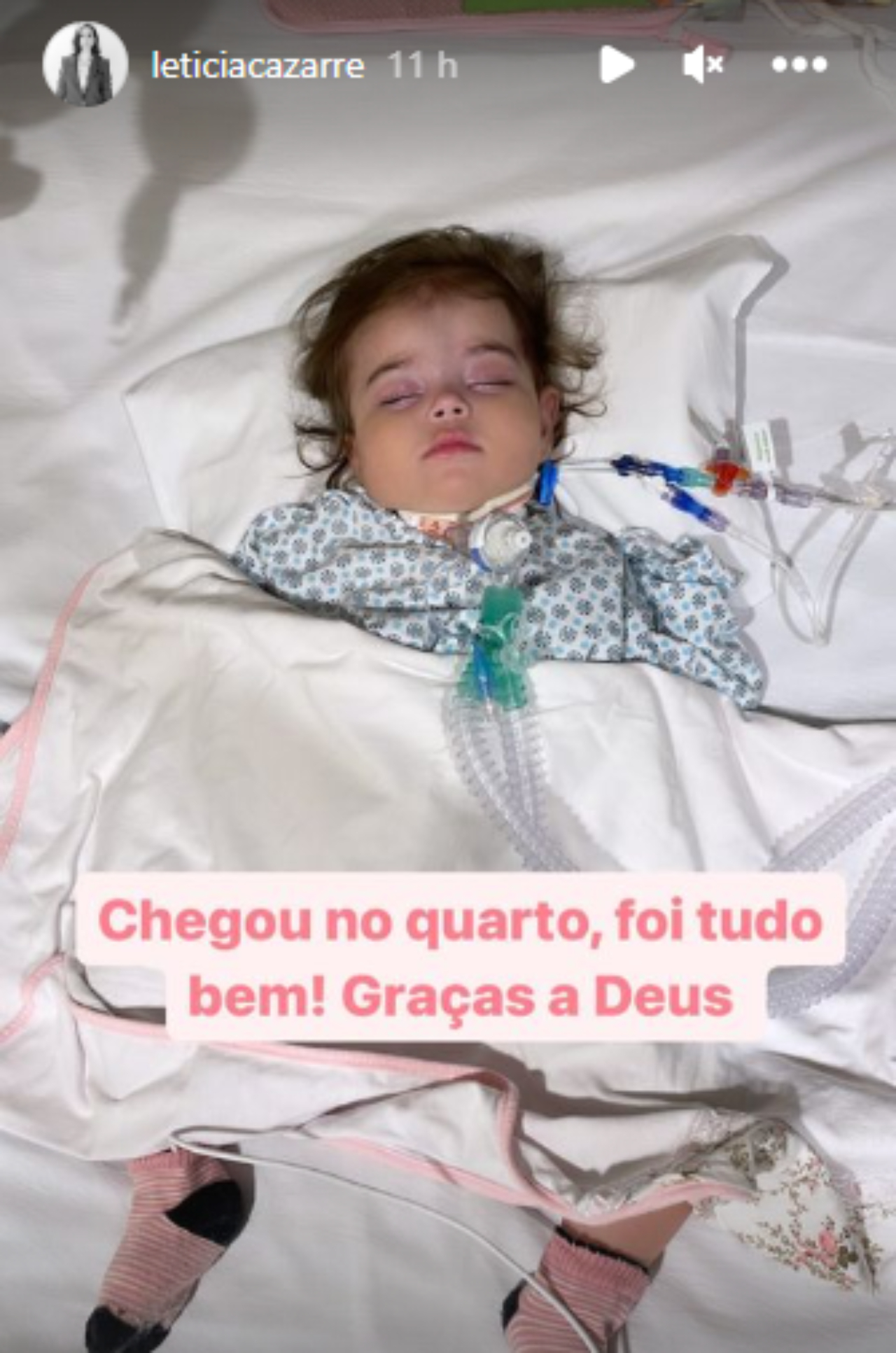 Filha de Juliano Cazarré, Maria Guilhermina passa pela 6ª cirurgia bem-sucedida