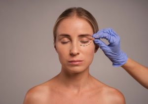 Minilifting, Lifting e Deep Plane: técnicas modernas antecipam a idade da cirurgia facial